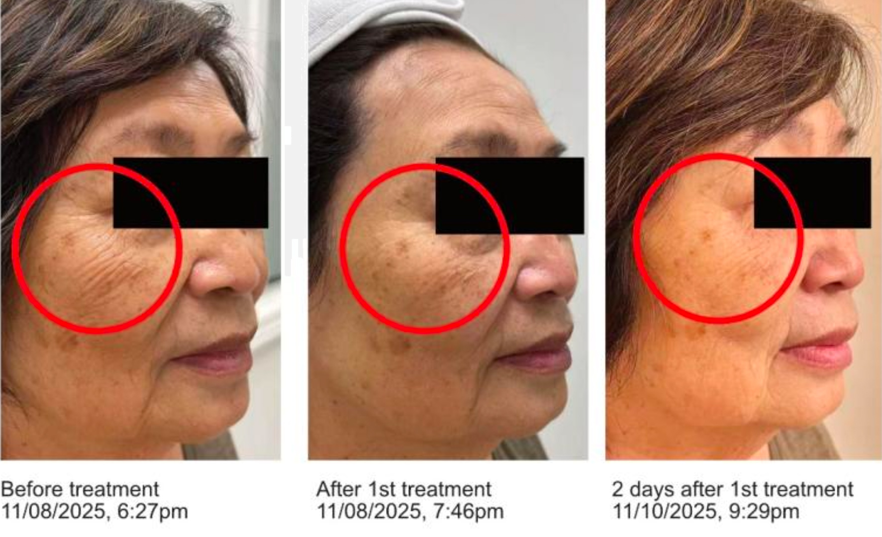 360 EXO images copy 3